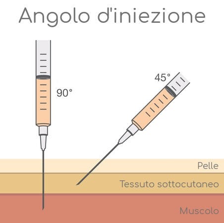 Angolo iniezione