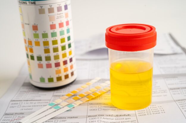 esame urine come si fa